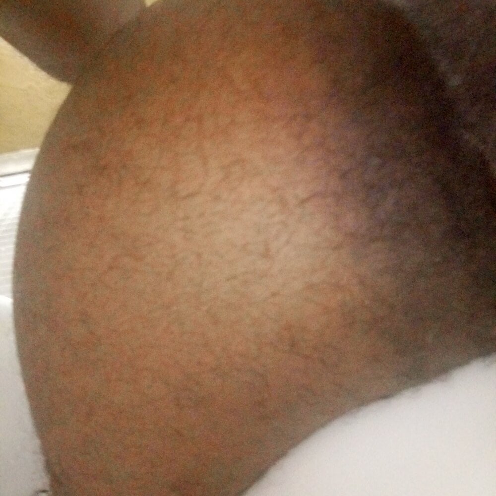 ASSNDDICK1