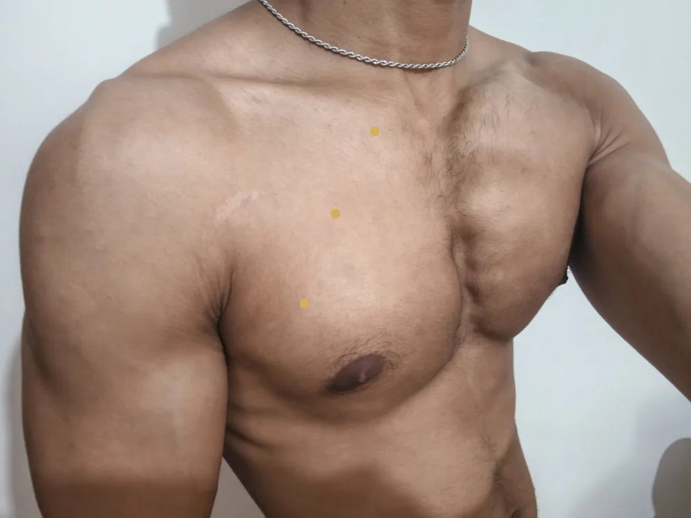 Brunodicc