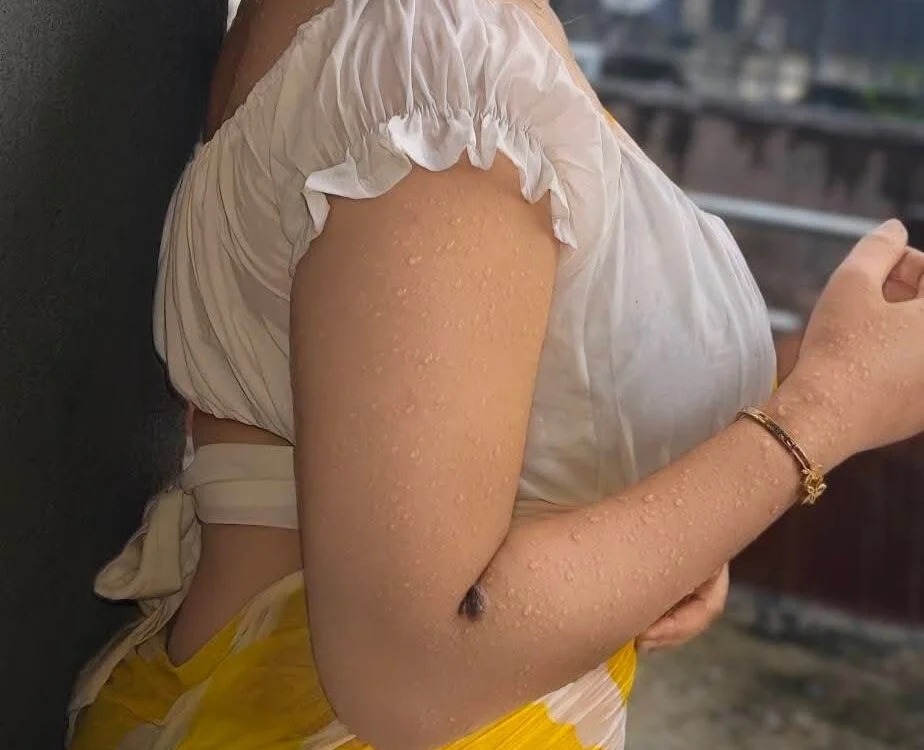 Dipa-Ranii