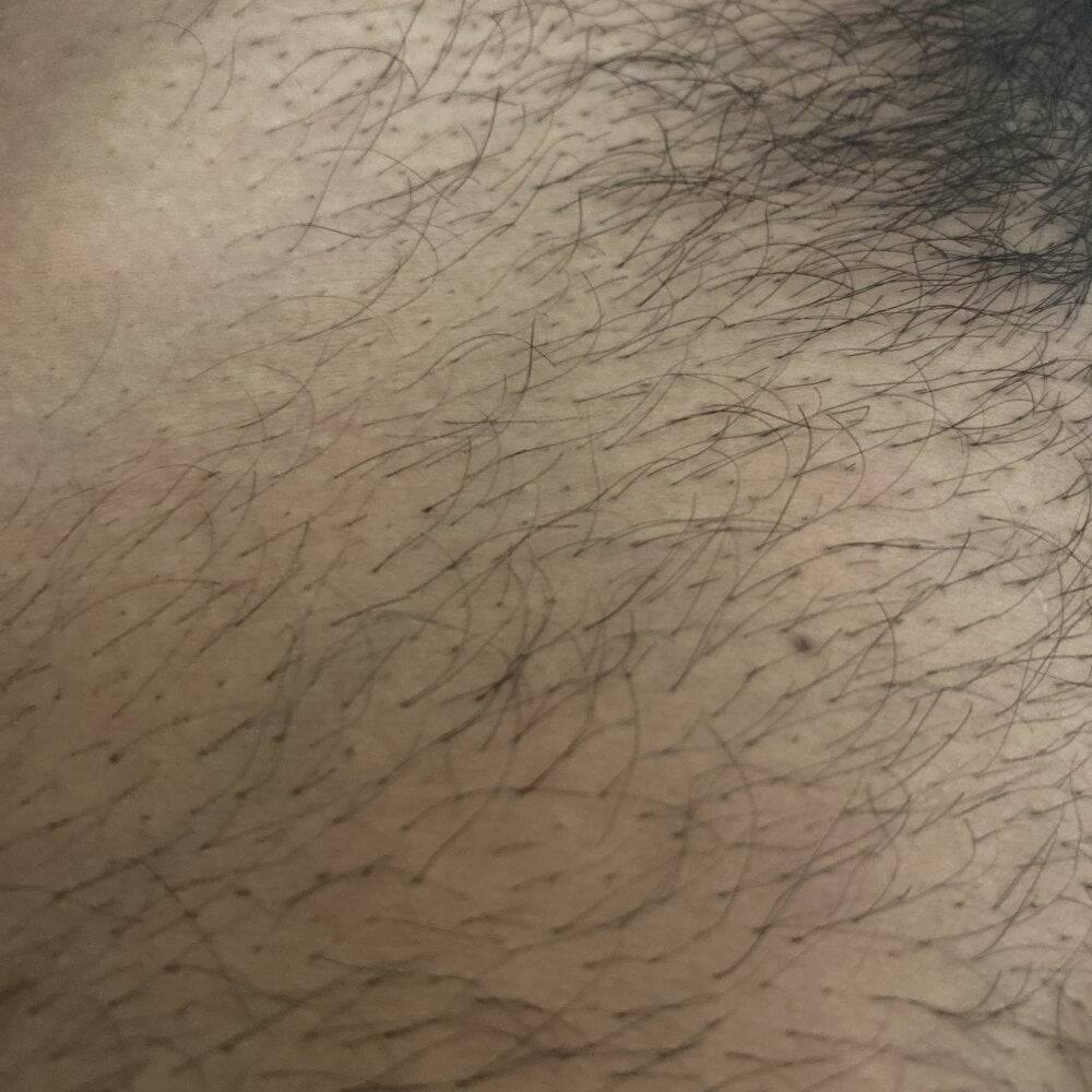 disporeelgrossebite